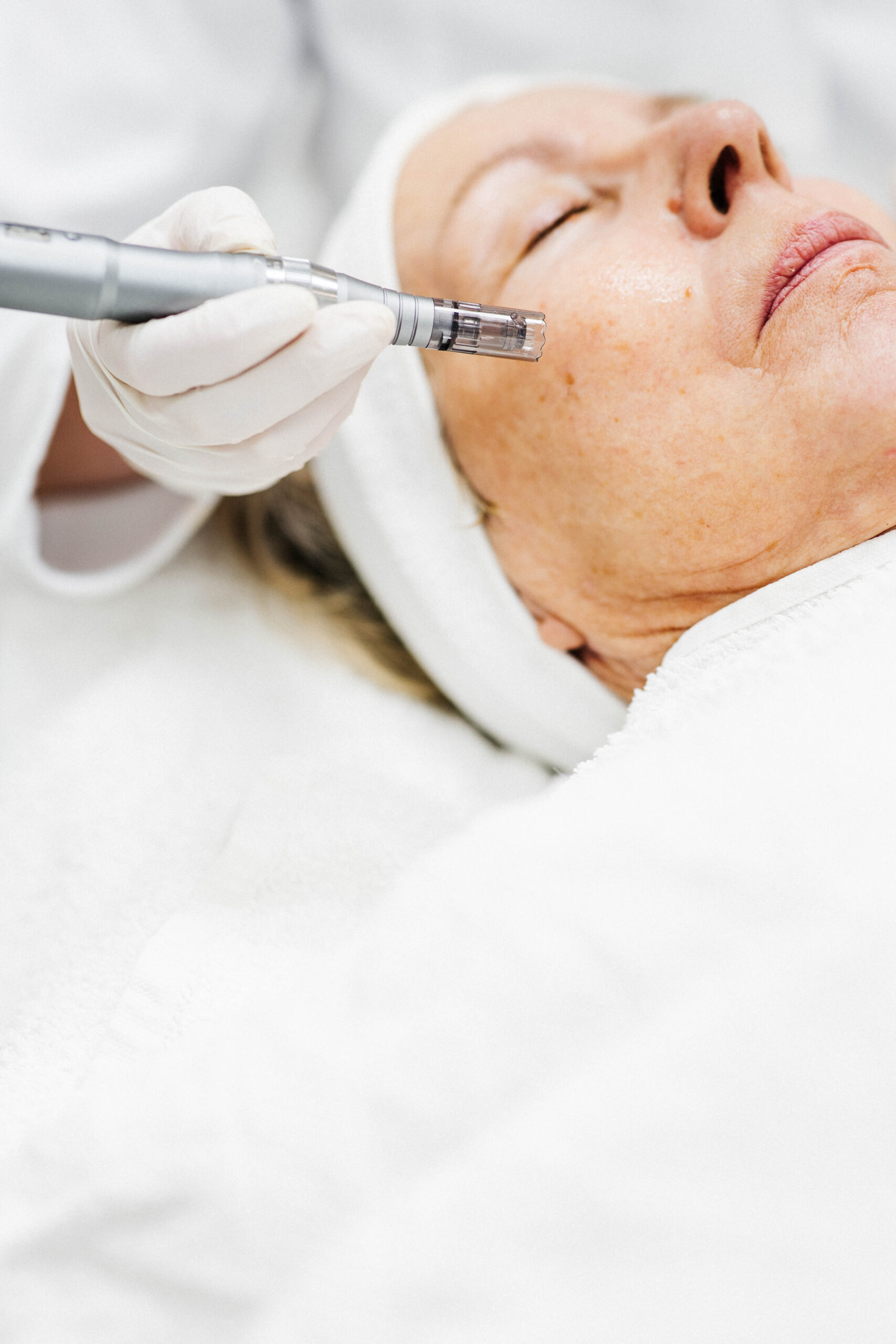 Dermapen