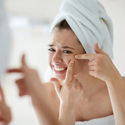 gistpuistjes acne