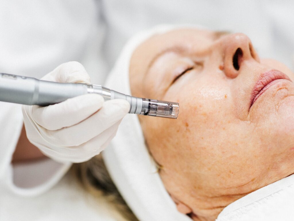 dermapen